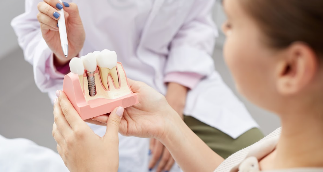 How Much Does It Cost To Get Dental Implants In The USA