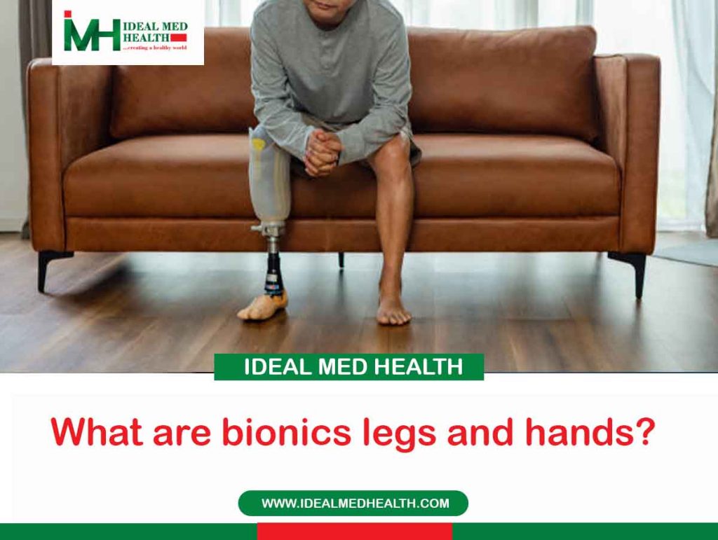 What are bionics legs and hands