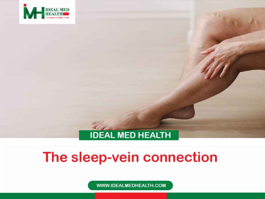 The sleep-vein connection